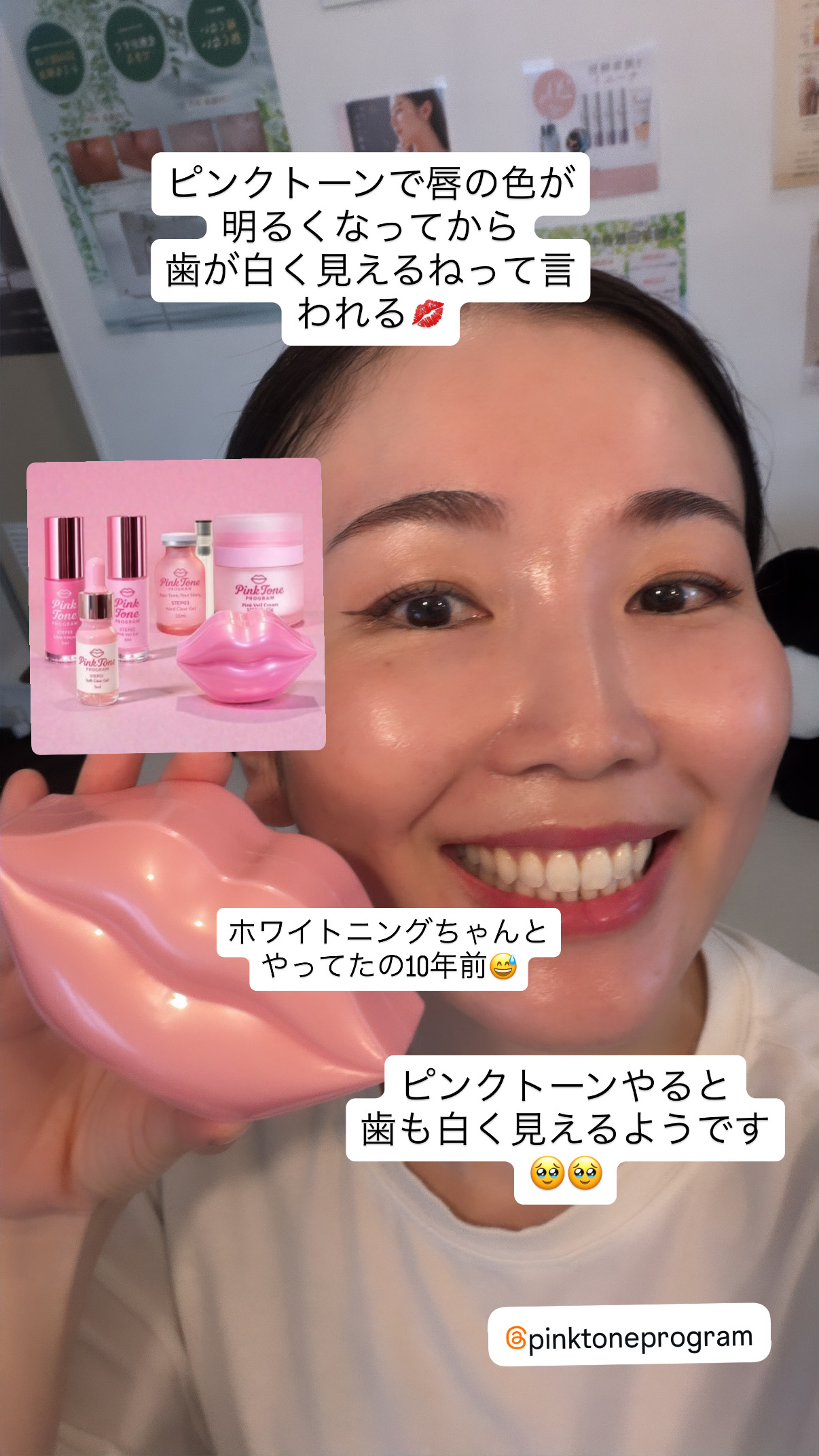 「ホワイトニングした?」と聞かれる理由は、実は唇でした!ピンクトーンで印象アップ♪